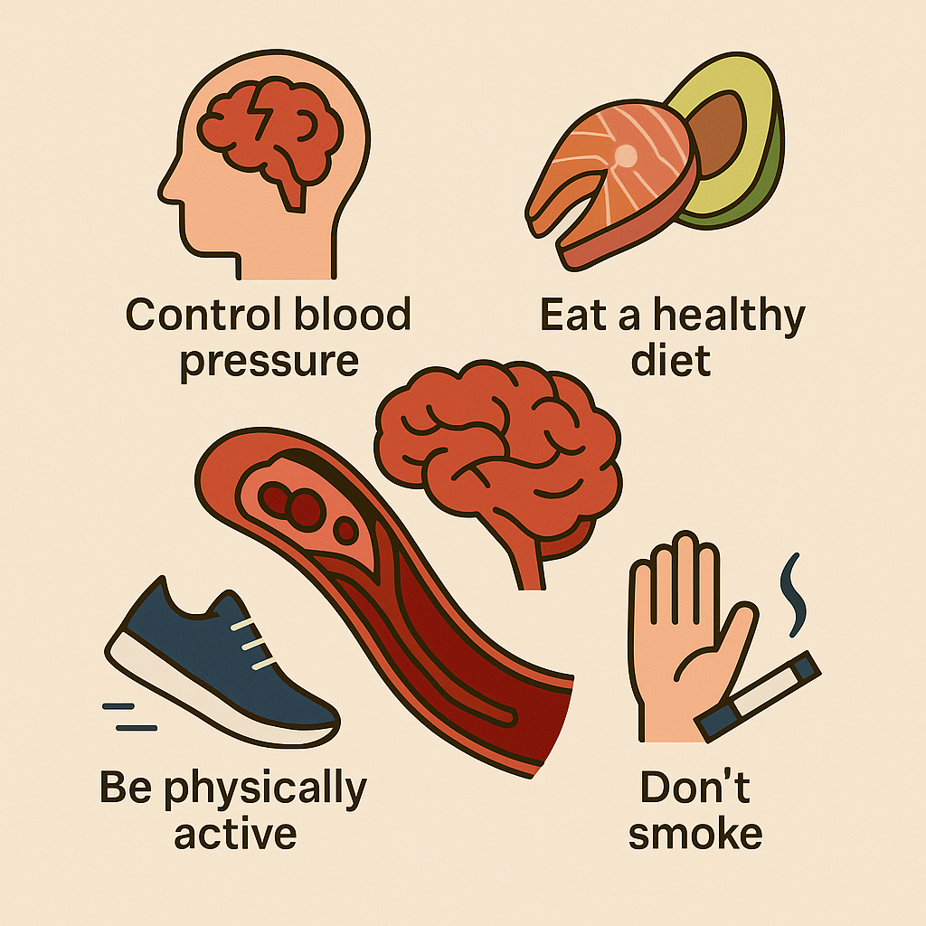 Infographic titled “Preventing Stroke” with illustrations of a brain and five prevention strategies: eat omega-3s, reduce sodium, stay active, control blood pressure, and manage stress.